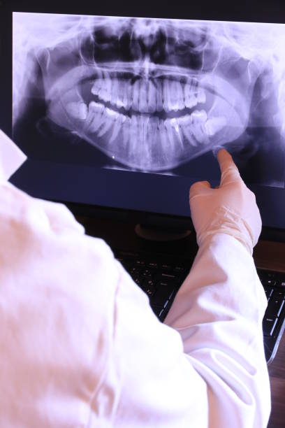 Best Emergency Dental Extractions in Mill Bay, AK